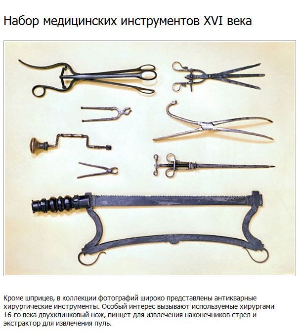 Медицинские инструменты минувших столетий (12 фото)