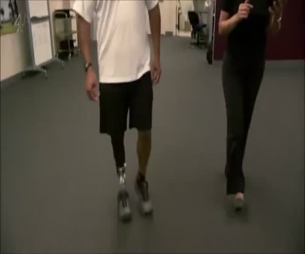 Уникальные бионические протезы