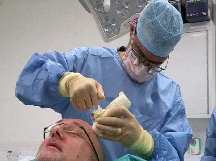 Операция на головном мозге сбривают ли все волосы