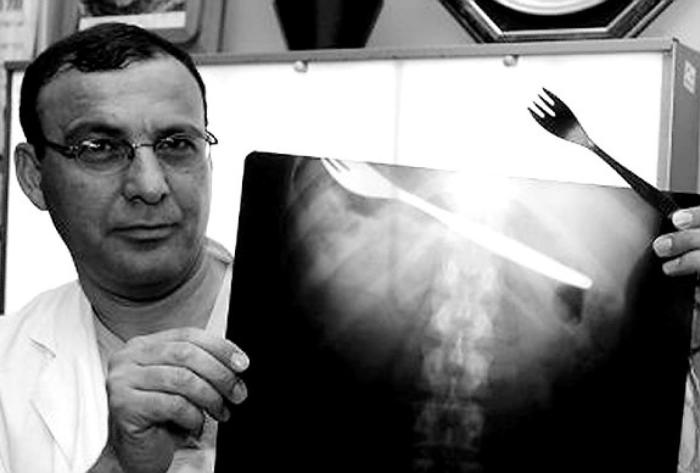 Необычные предметы в теле людей на рентгеновских снимках (37 фото)