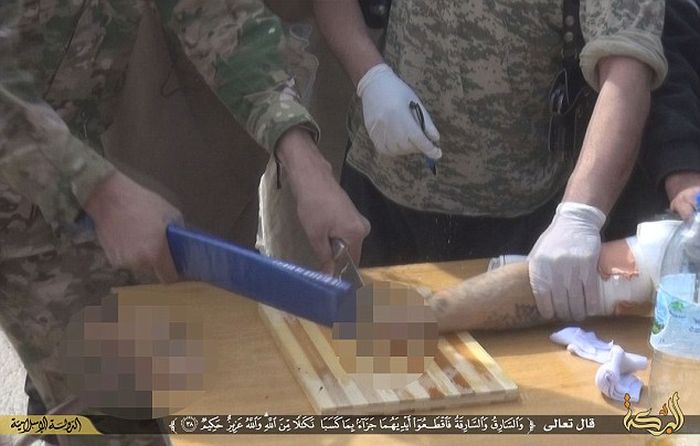 Боевики ИГИЛа вновь отрубили руку вору (8 фото)