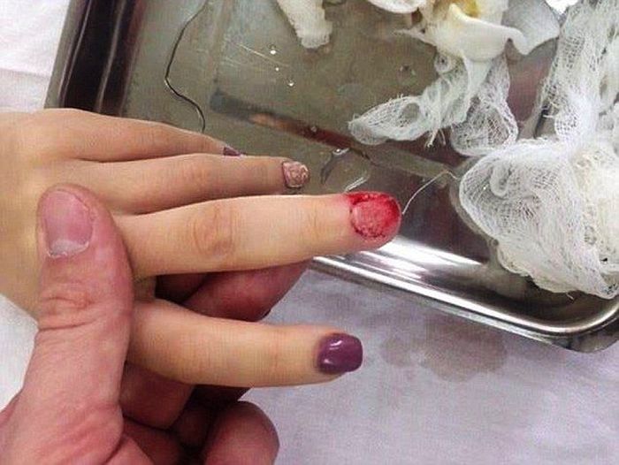 За критику в свой адрес мастер маникюра вырвала ногти клиентке (5 фото)