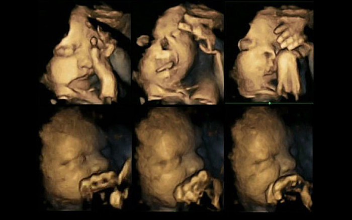 Реакция ребенка в утробе матери на курение (2 фото)