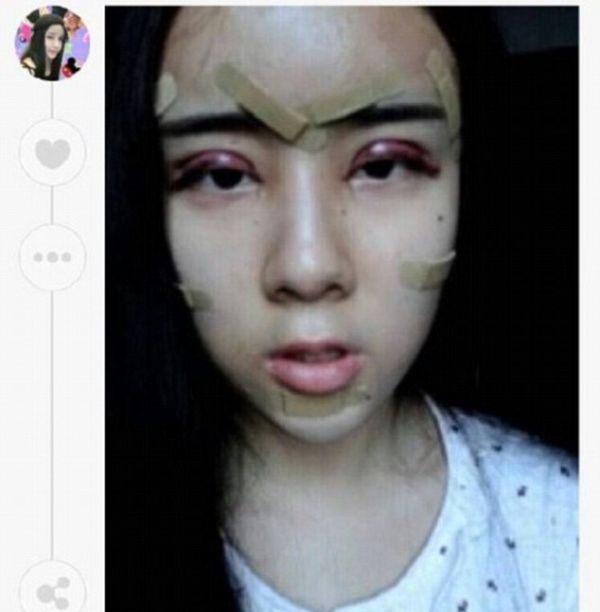 15-летняя китаянка стала звездой интернета после пластической операции (11 фото)
