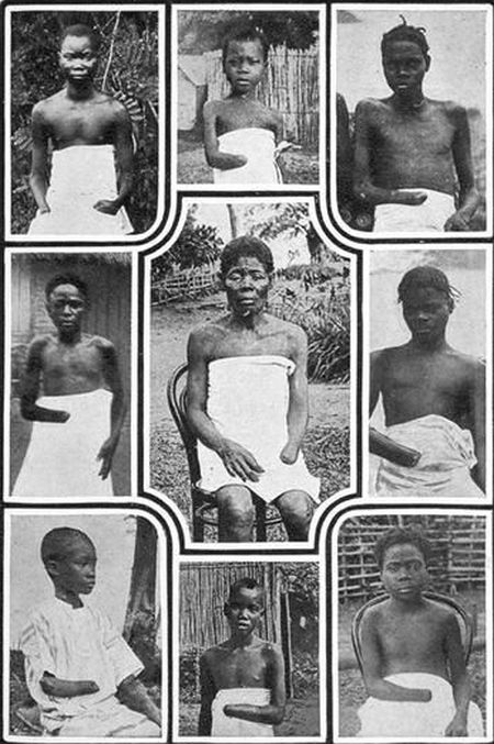 Каучуковый геноцид коренного населения Конго (11 фото)