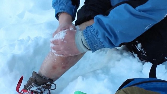 Русский альпинист сам прооперировал себе ногу, используя снег в качестве анестезии (6 фото + видео)