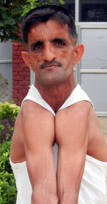 Раммехар Пуня, «резиновый человек» из Индии, побил собственный рекорд (6 фото + видео)