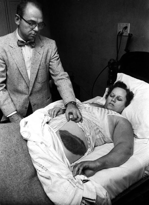 Энн Ходжес - первая женщина, пострадавшая от предмета внеземного происхождения (3 фото)