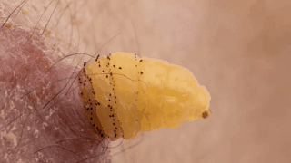 Подборка гифок с насекомыми и паразитами (20 гифок)