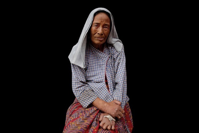 Обитатели колонии прокаженных в Непале (24 фото)