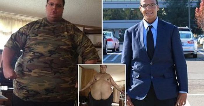 Американец похудел на 181 кг и столкнулся с проблемой лишней кожи (7 фото)