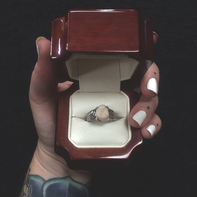 Парень сделал предложение девушке, подарив ей кольцо с собственным зубом мудрости (5 фото)