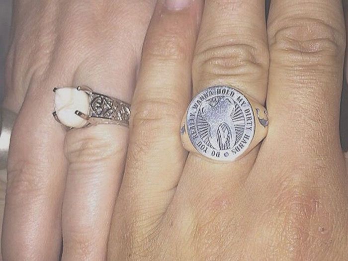 Парень сделал предложение девушке, подарив ей кольцо с собственным зубом мудрости (5 фото)