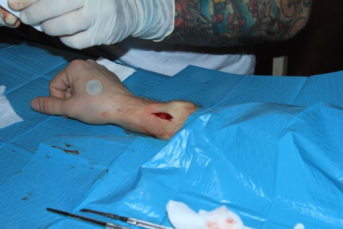 Биохакеры вживили под кожу имплантаты со светодиодами (10 фото)
