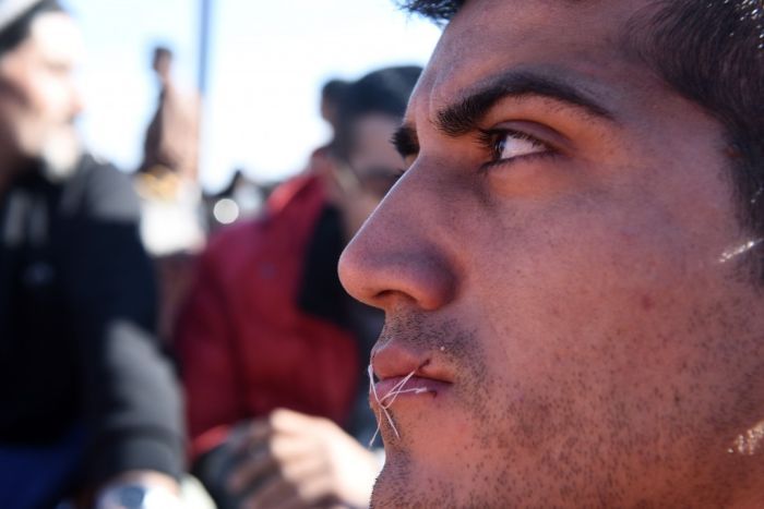 Иранские мигранты, которых не пустили в Македонию, в знак протеста зашили себе рты (6 фото)
