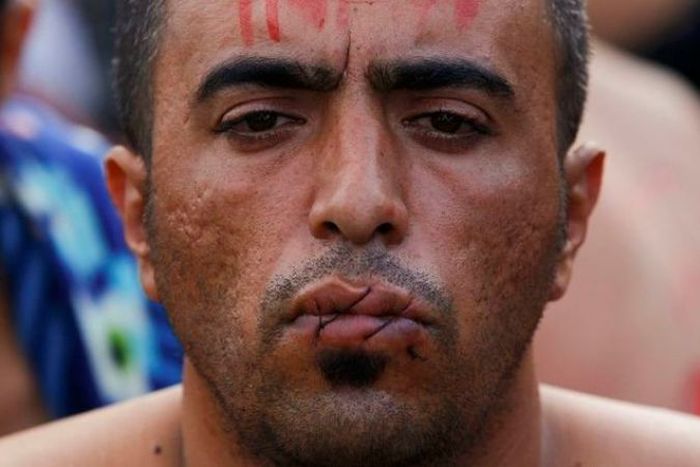 Иранские мигранты, которых не пустили в Македонию, в знак протеста зашили себе рты (6 фото)