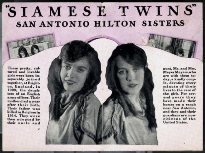 Сиамские близнецы сестры Хилтон, ставшие звездами водевиля (19 фото + видео)