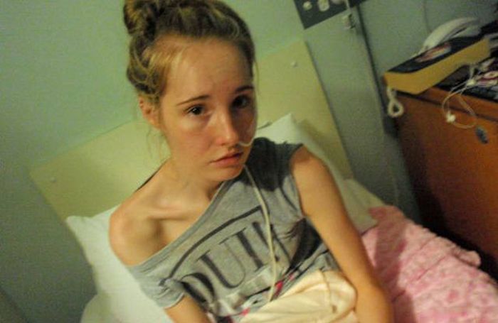Больная анорексией девушка набрала 40 кг за 7 месяцев (16 фото)
