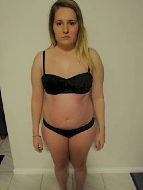 Больная анорексией девушка набрала 40 кг за 7 месяцев (16 фото)