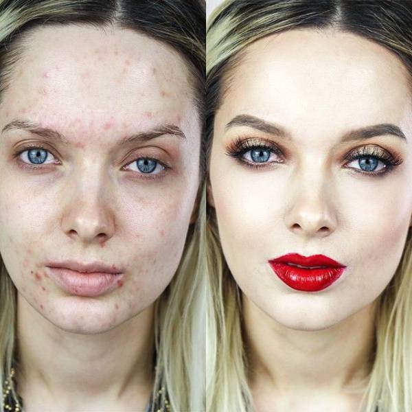 Проблемная кожа и чудеса макияжа (22 фото)