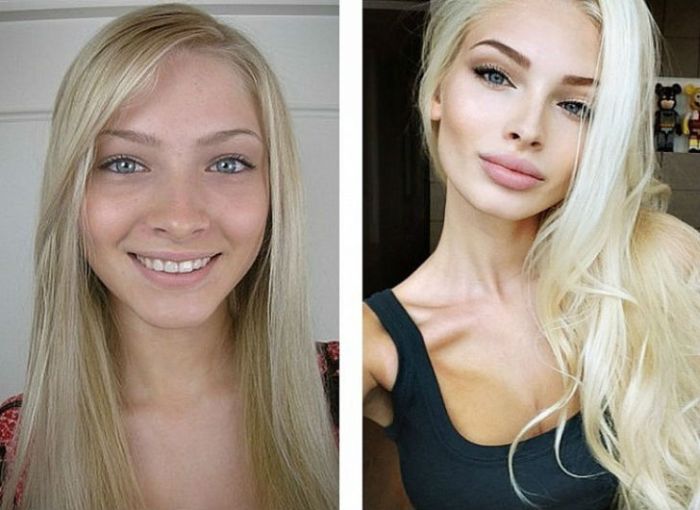 Известные россиянки до и после пластики (10 фото)