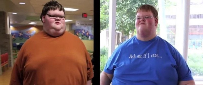 Как 320-килограммовый 15-летний подросток похудел вдвое (8 фото)
