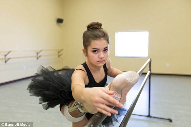 Девушка с ампутированной ногой стала превосходной танцовщицей (10 фото)