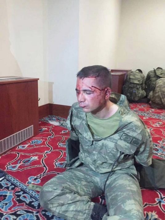 Как поступили с участниками военного мятежа в Турции (18+) (13 фото + видео)