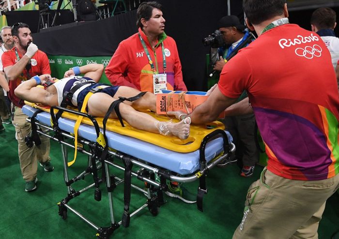 Французский гимнаст получил двойной перелом ноги на Олимпиаде в Рио-де-Жанейро (7 фото + видео)