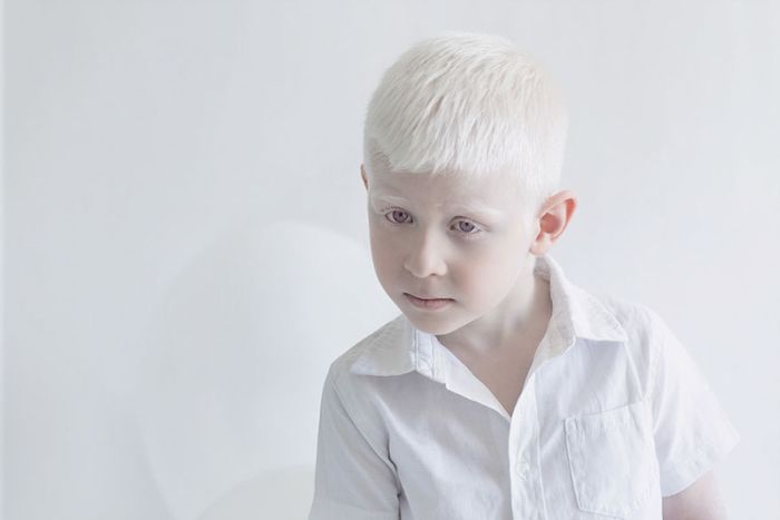 Уникальная красота людей-альбиносов (32 фото)