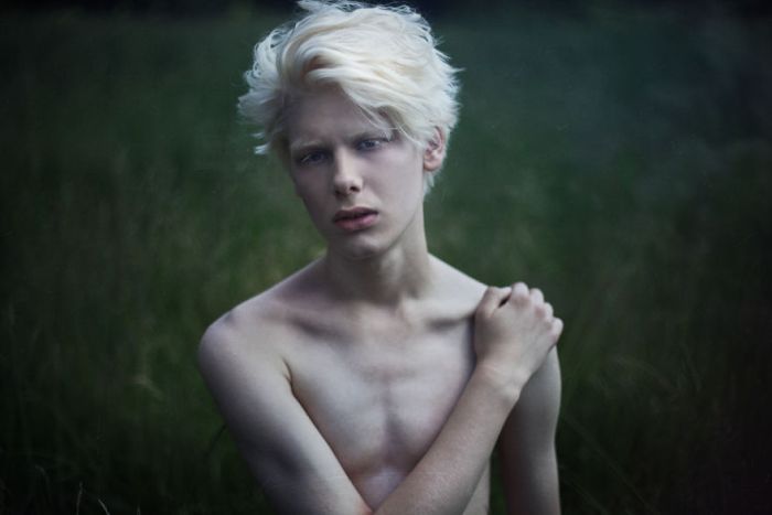 Уникальная красота людей-альбиносов (32 фото)