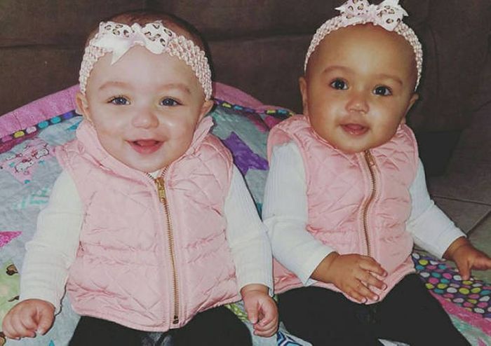 Сестры-близнецы с разным цветом кожи покорили пользователей сети (5 фото)