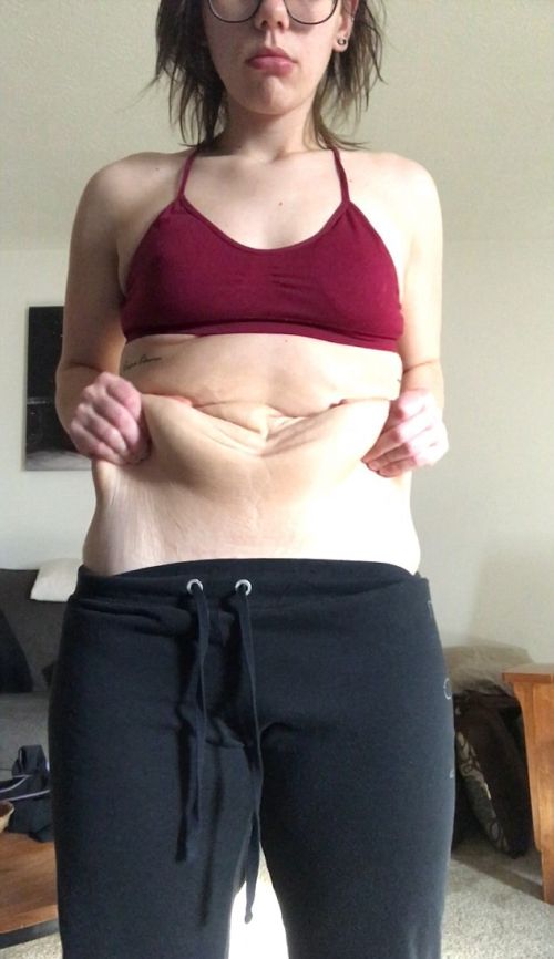 Девушка похудела на 63 кг из-за неразделенной любви (10 фото)