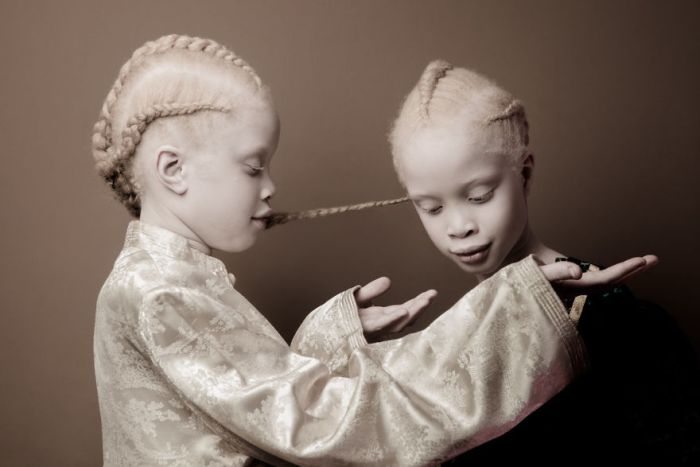 11-летние сестры-альбиносы покорили мир моды (11 фото)