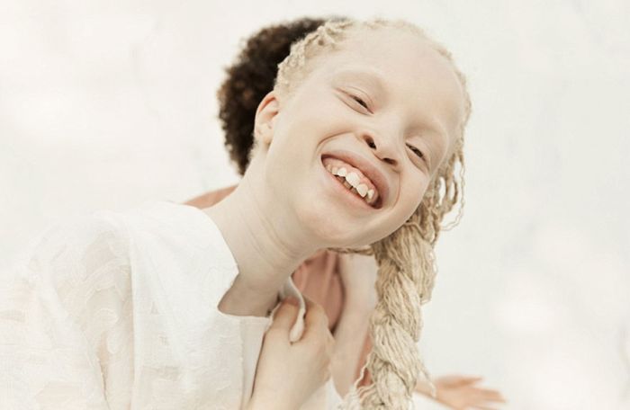 11-летние сестры-альбиносы покорили мир моды (11 фото)