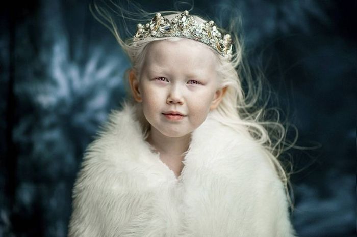8-летняя девочка-альбинос Нарияна, которую зовут «Снежной королевой» (7 фото)