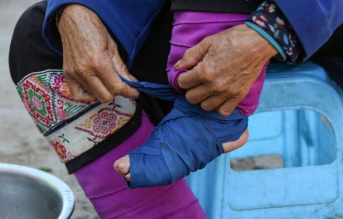Пожилые китаянки с деформированными стопами (10 фото)