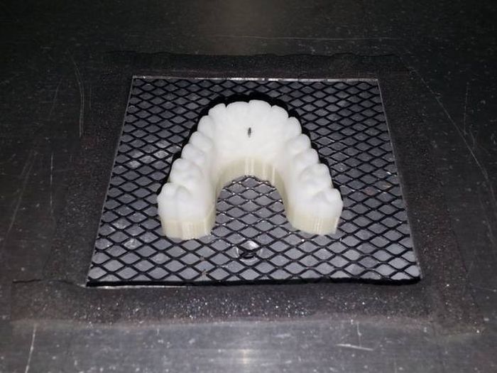 Парень выровнял зубы с помощью самодельных брекетов, напечатанных на 3D-принтере (11 фото)