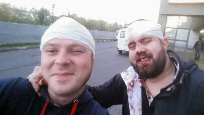 Александр Орлов, ударивший журналиста НТВ Никиту Развожаева, хочет договориться (8 фото)