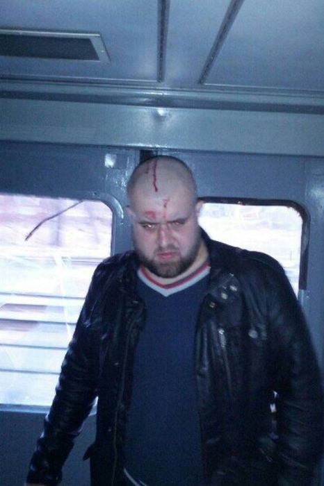 Александр Орлов, ударивший журналиста НТВ Никиту Развожаева, хочет договориться (8 фото)