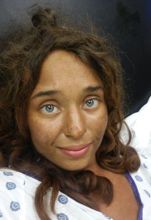 В США нашли заблудившуюся девушку, которая провела месяц в лесу (2 фото)