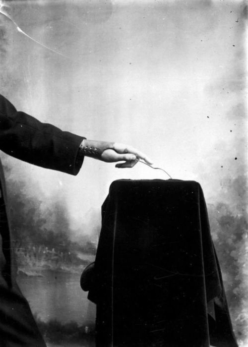 Протезы Джеймса Гиллингхэма, опередившие свое время (20 фото)