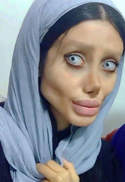 Иранка перенесла 50 операций, чтобы стать похожей на Анджелину Джоли (12 фото)