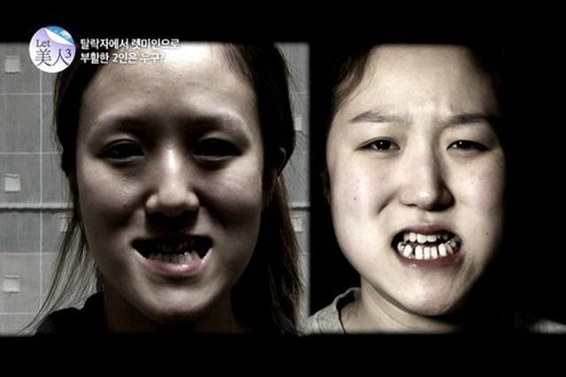 Чудесное преображение корейских близняшек (11 фото)