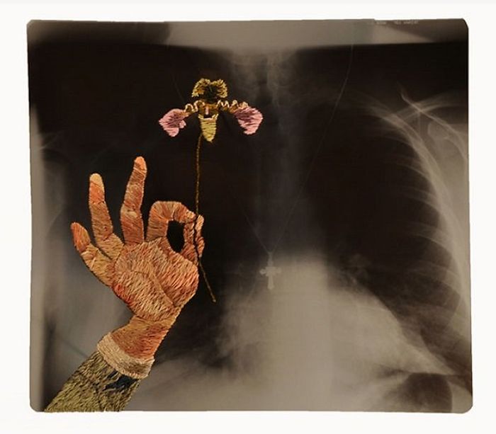 Рентгеновские снимки, дополненные вышивкой (23 фото)