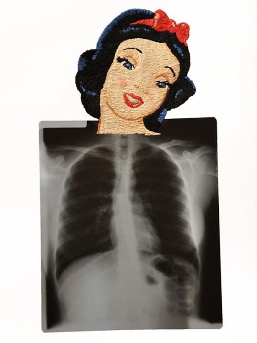 Рентгеновские снимки, дополненные вышивкой (23 фото)