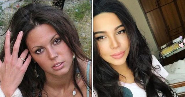 Российские звезды Instagram до и после пластических операций (15 фото)