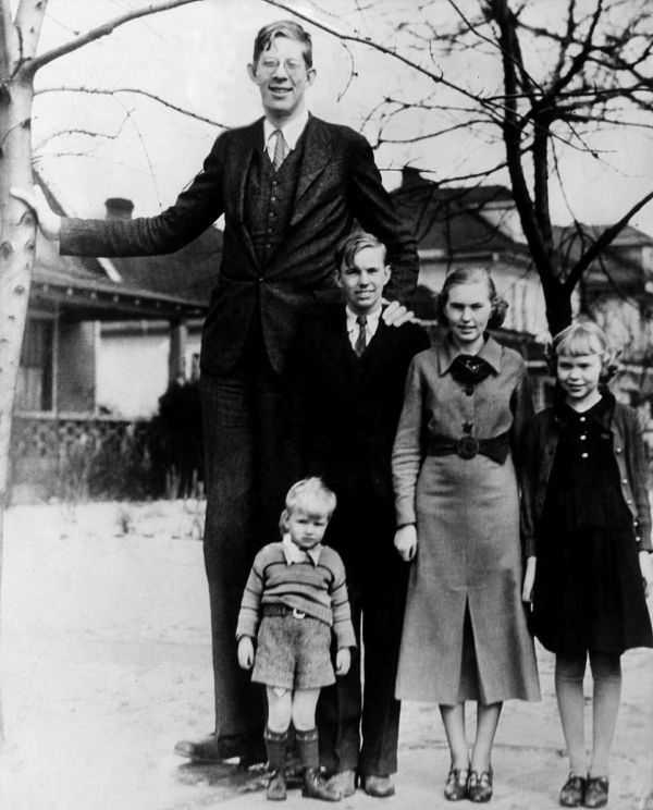 Роберт Уодлоу - самый высокий человек (14 фото + видео)