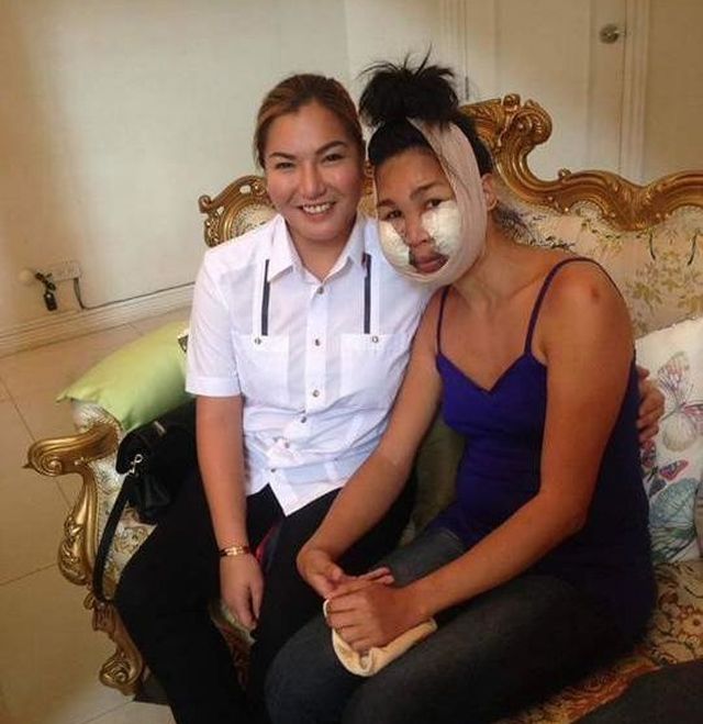 Подпольный косметолог изуродовала лица девушек (5 фото)