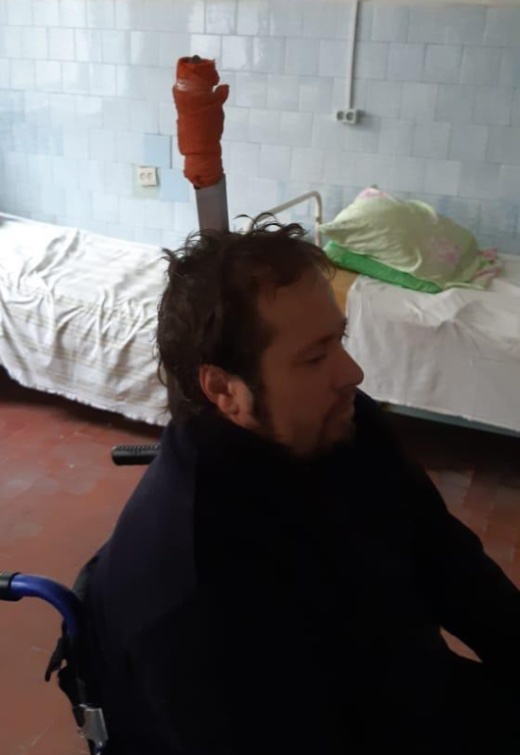 В Ростове мужчина воткнул себе в голову нож (3 фото + видео)